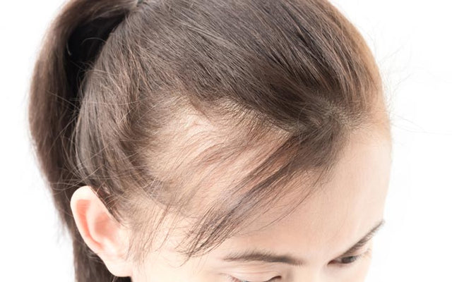 How to Fix Uneven Hairline Female