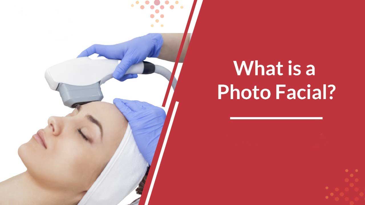 What Is a Photofacial?