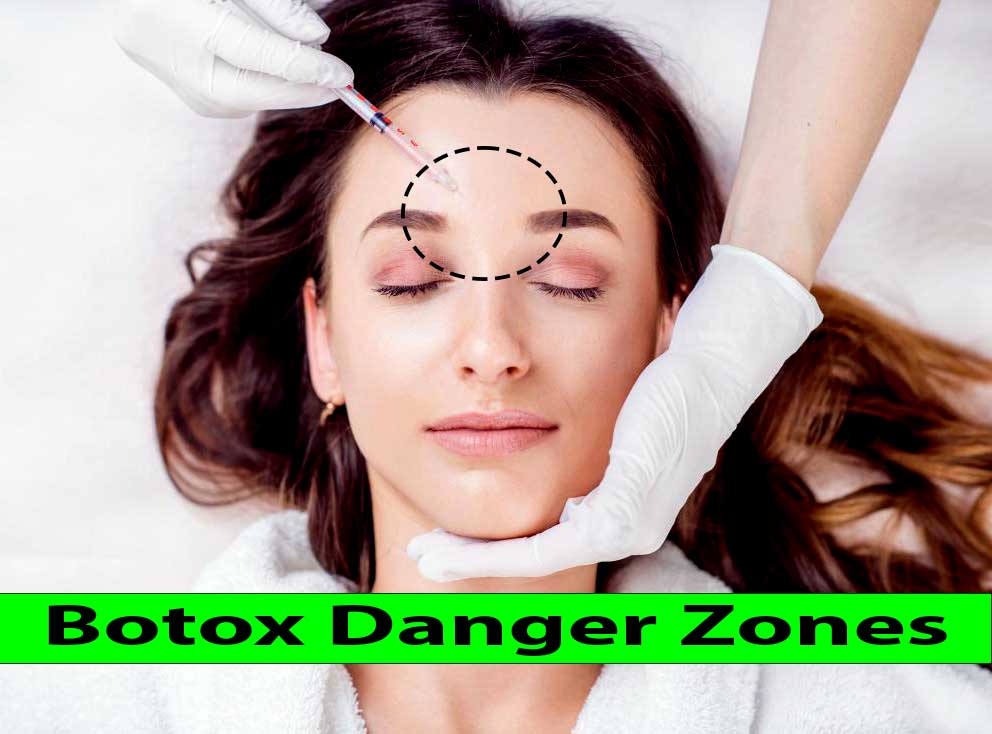 Botox Danger Zones
