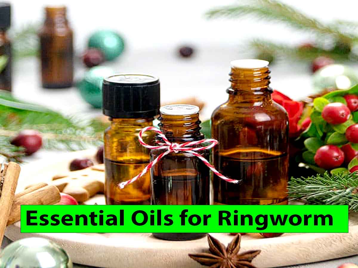 Essential Oils for Ringworm