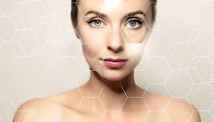 How to Restore Collagen in the Face