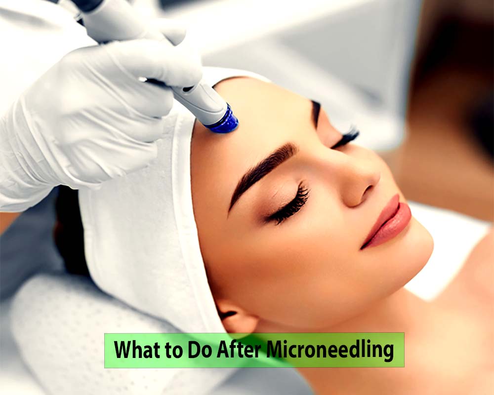 What to Do After Microneedling